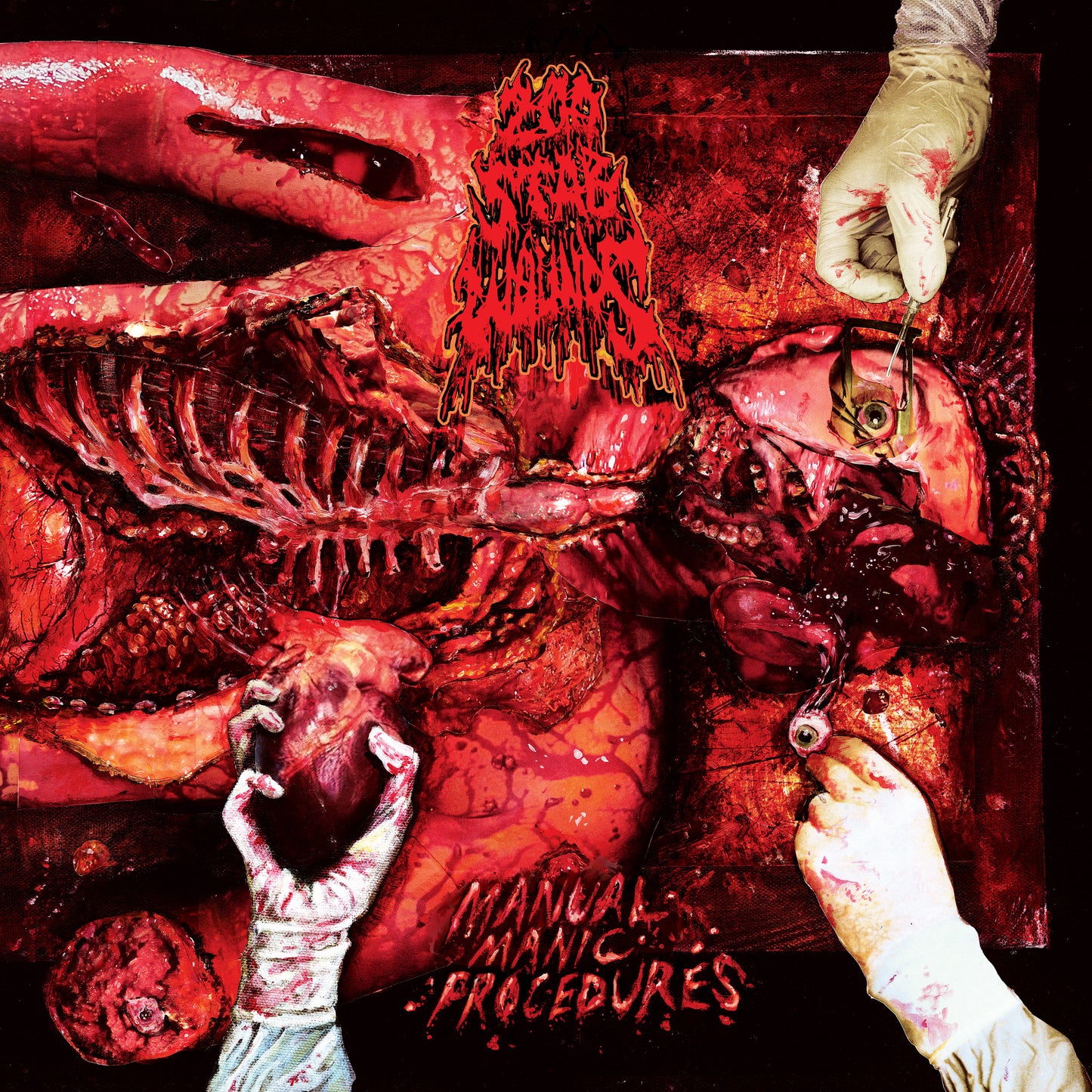 200 STAB WOUNDS - MANUAL MANIC PROCEDURES