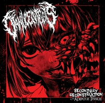 OTAKUCENTESIS - SECONDARY RECONSTRUCTION OF ADIPOSE TISSUE [CD]